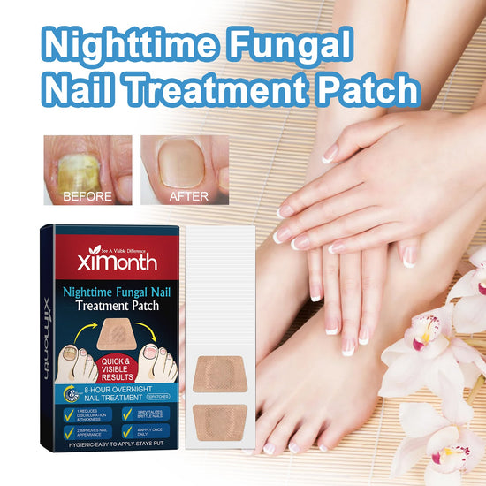 Nighttime Fungal Nail Treatment Patch, Repair Hand And Foot Inlay Rotten Nails Thickening Gray Nail Polish Care Patch