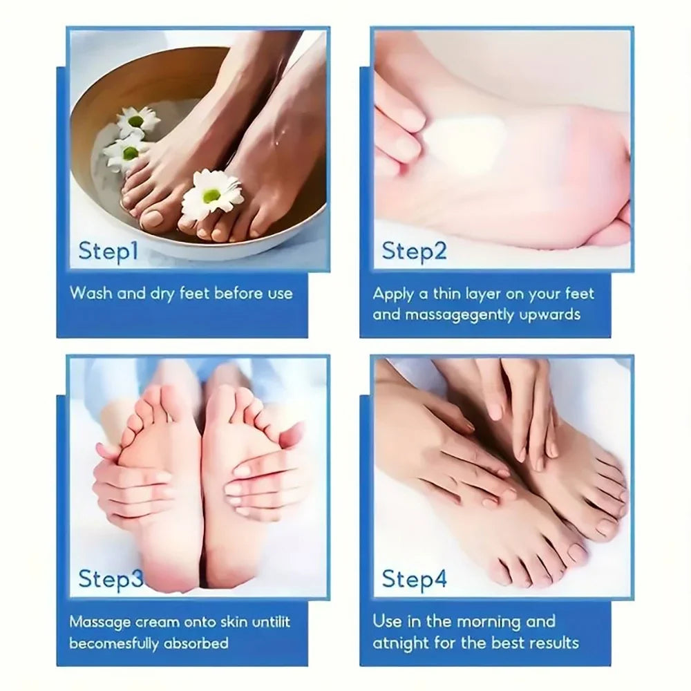 SUYARUN 60% Urea Foot Cream for Cracked Heels & Dry Skin - Intensive Moisturizing Treatment, Callus Remover, Diabetic Foot Care.